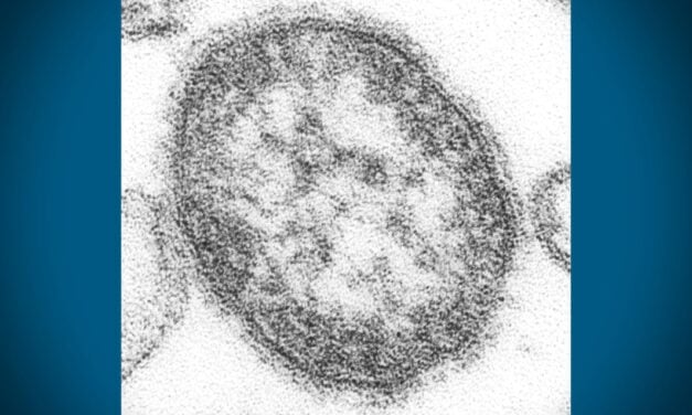 Measles exposure reported at Sea-Tac Airport; health officials urge vaccination check