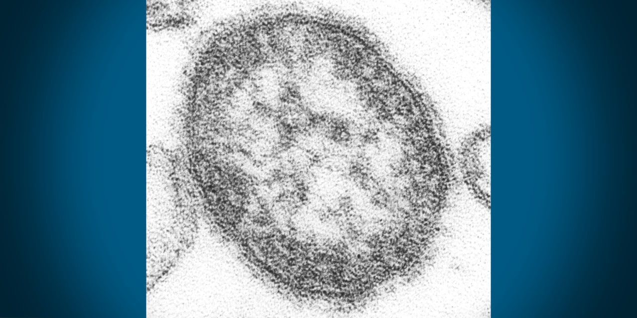 Measles exposure reported at Sea-Tac Airport; health officials urge vaccination check